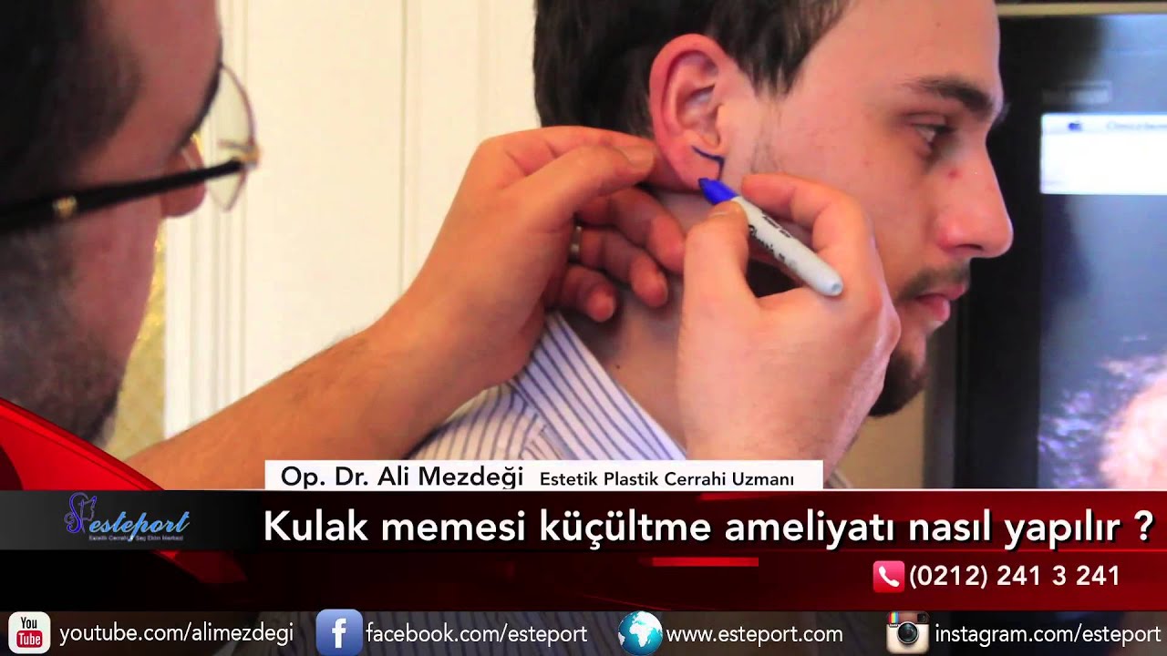 Kulak Memesi K&uuml;&ccedil;&uuml;ltme Estetiği  Ameliyatı & Dr Ali Mezdeği