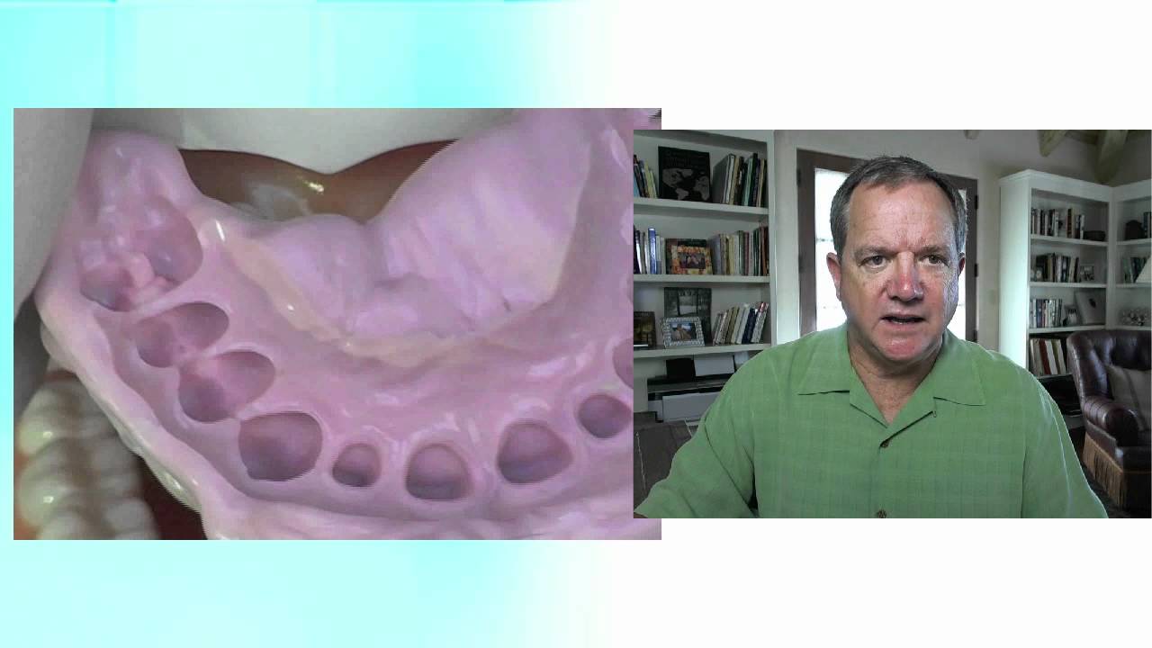 Anterior Temporaries, Part 2