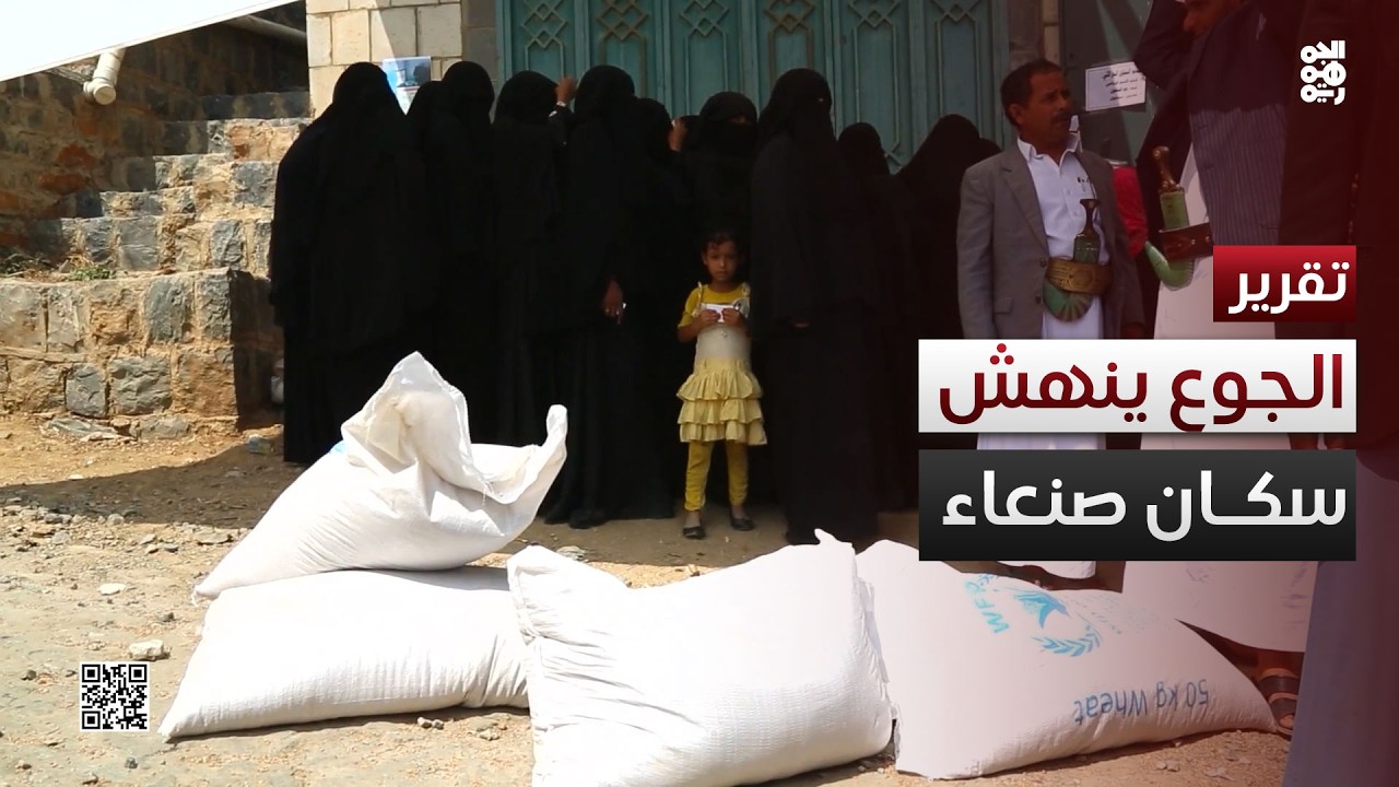 صنعاء.. عاصمة ينهشها الجوع