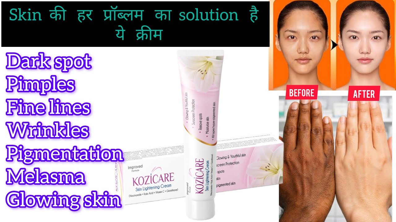 स्किन होगी साफ एक बार लगाते ही | Chehre ki har problem ka solution he ye cream | Kozicare cream