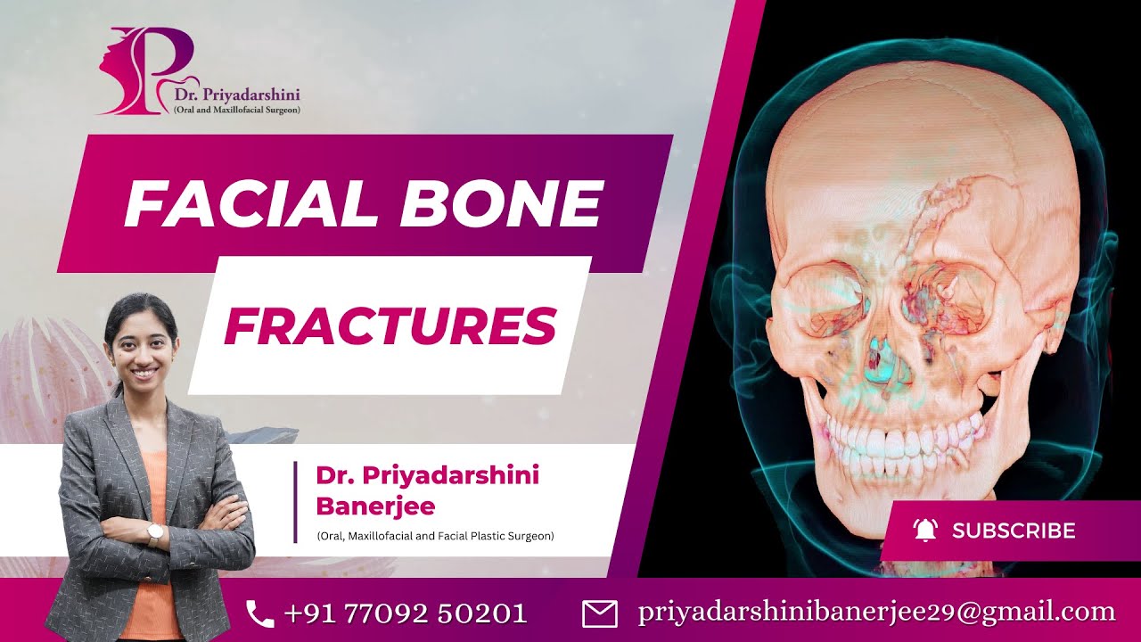 Facial Bone Fractures | - Dr. Priyadarshini Banerjee