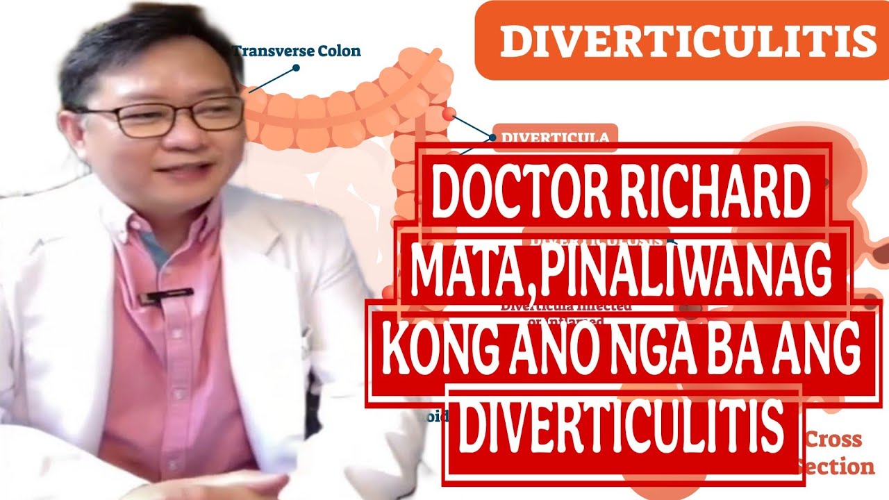 ANO NGA BA ANG DIVERTICULITIS? PINALIWANAG NI DOCTOR RICHARD MATA 