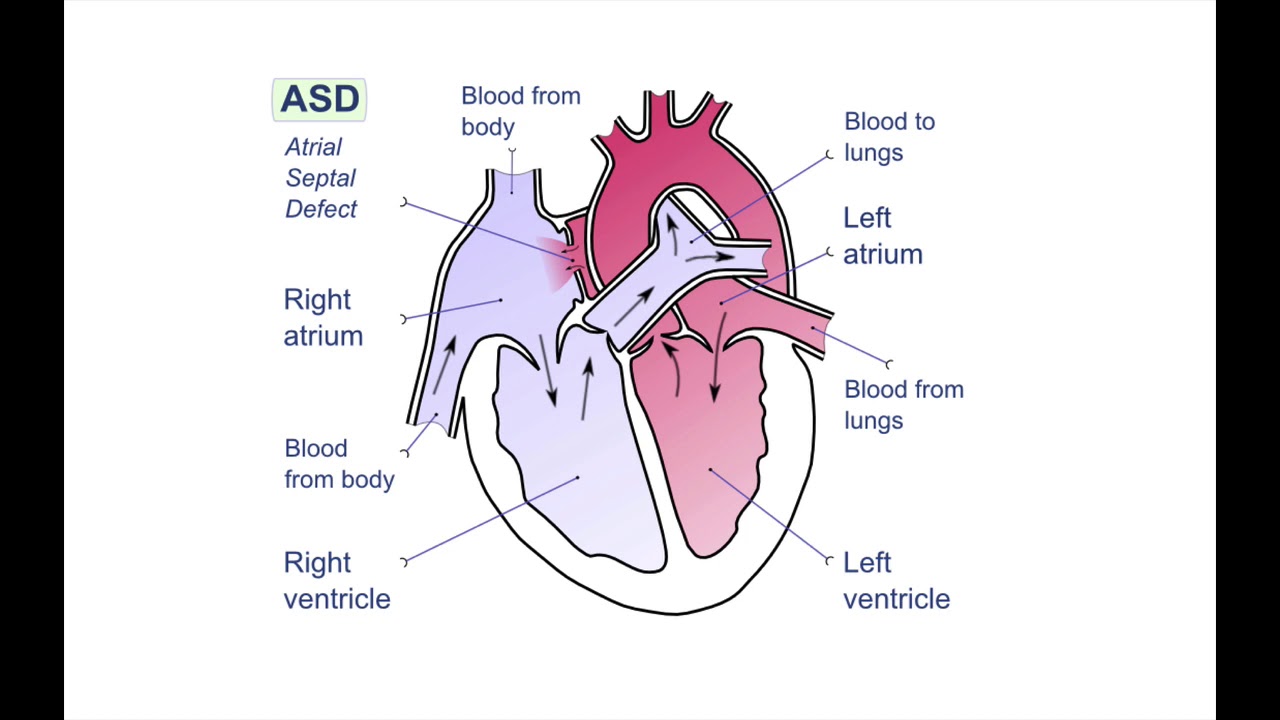 Paediatrics - cardiology
