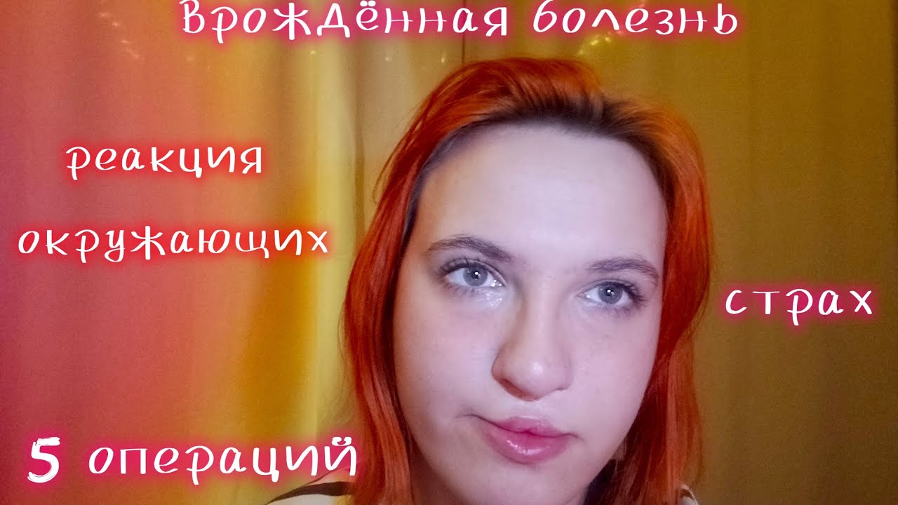 Расщелина губы и нёба, моя история 🖤
