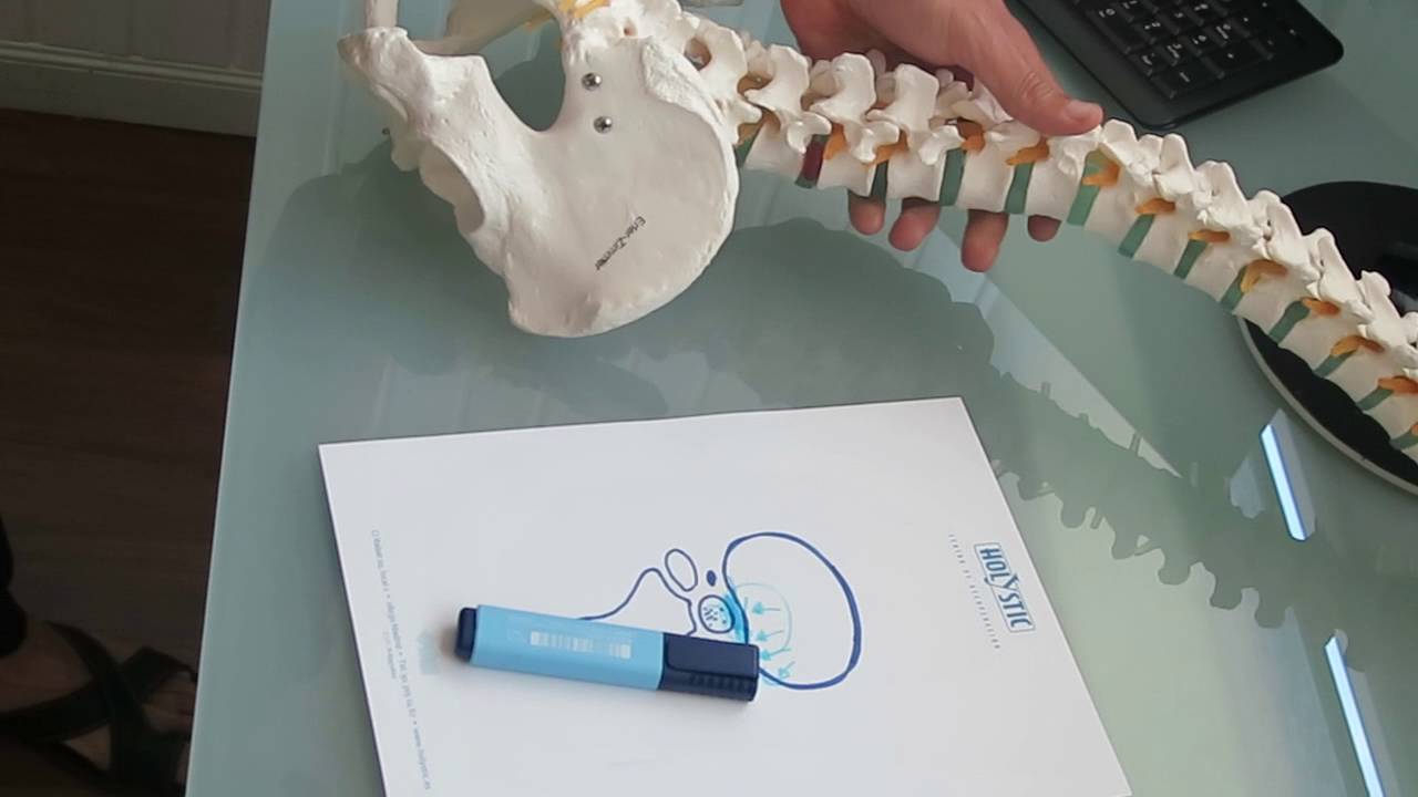 Osteo-consejo 3: Bombeo discal