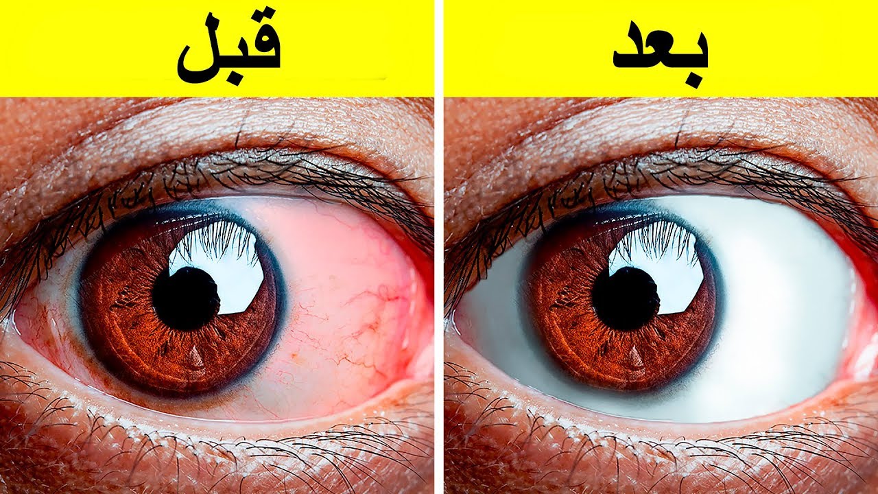 إليك 10+ تمارين سهلة لإراحة العيون المتعبة