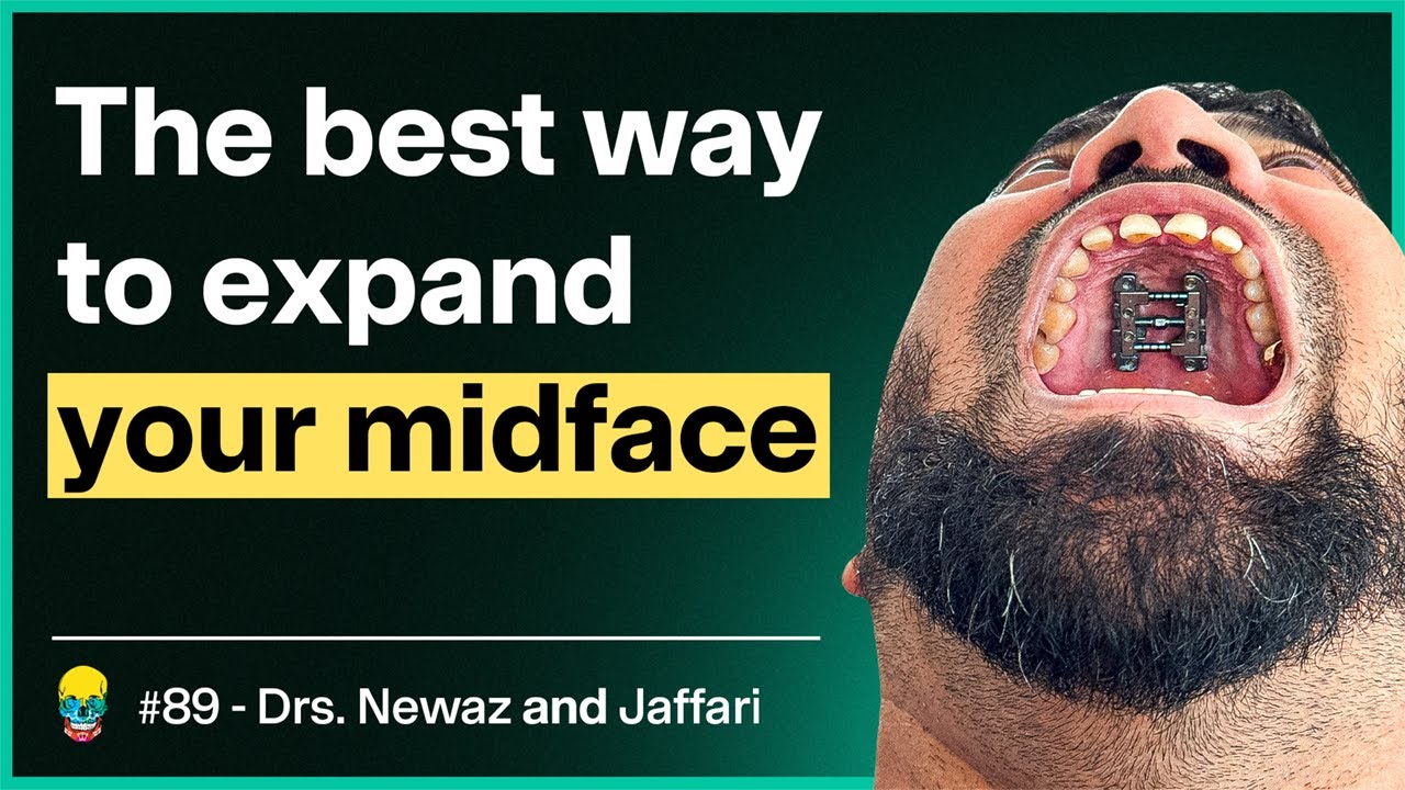 This Orthodontist Expanded His Maxilla 9mm with FME | #89 Dr. Newaz and Dr. Jaffari
