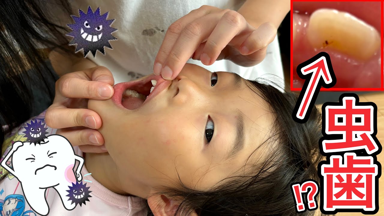 「痛いの？」ここちゃんついに虫歯⁉️歯医者さんで削ってもらおうか😭❓❓❓