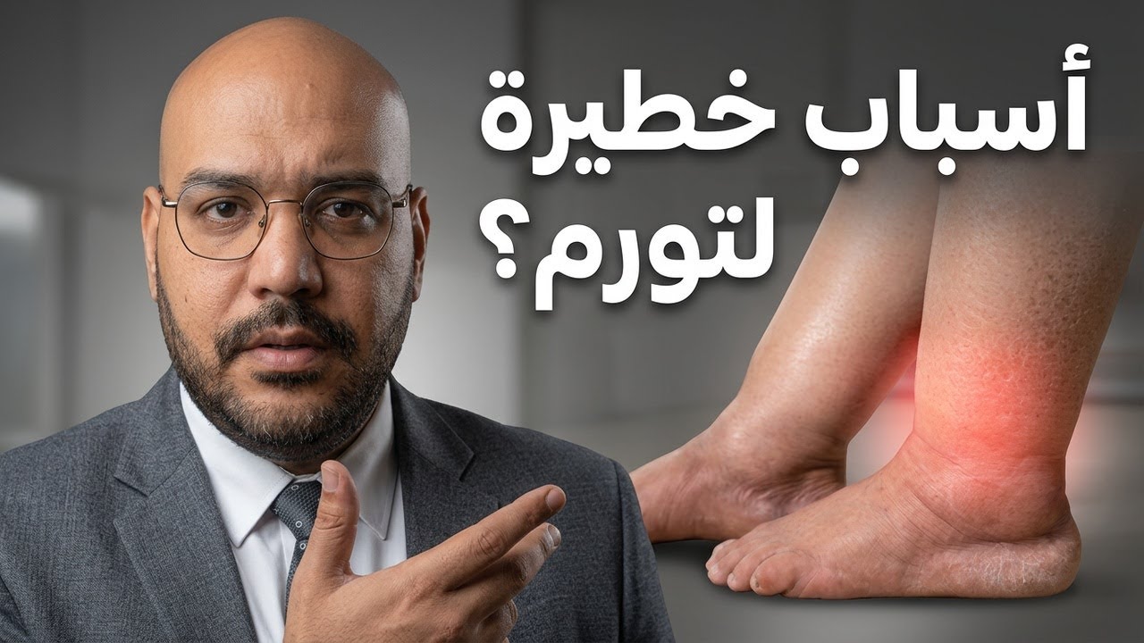 تورم الساقين: الدليل الشامل للأسباب الخطيرة والتشخيص والعلاج الصحيح