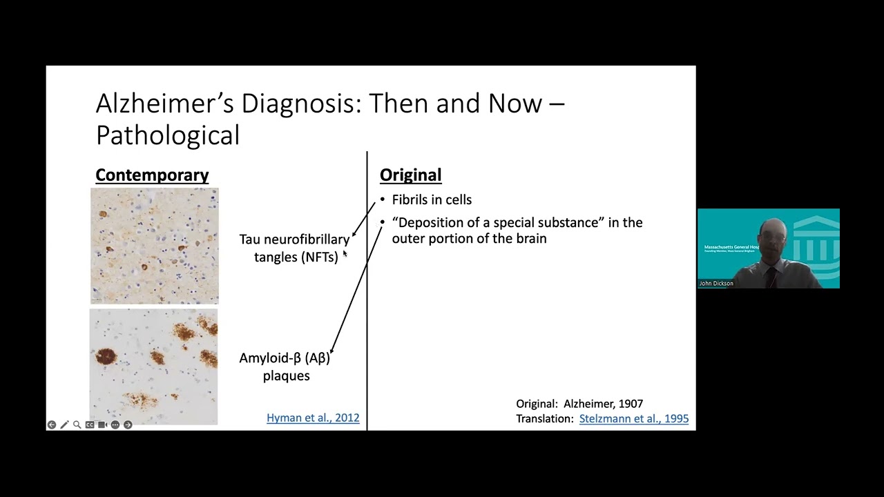 Blum Center Program: Alzheimer's Disease Diagnosis and Treatment
