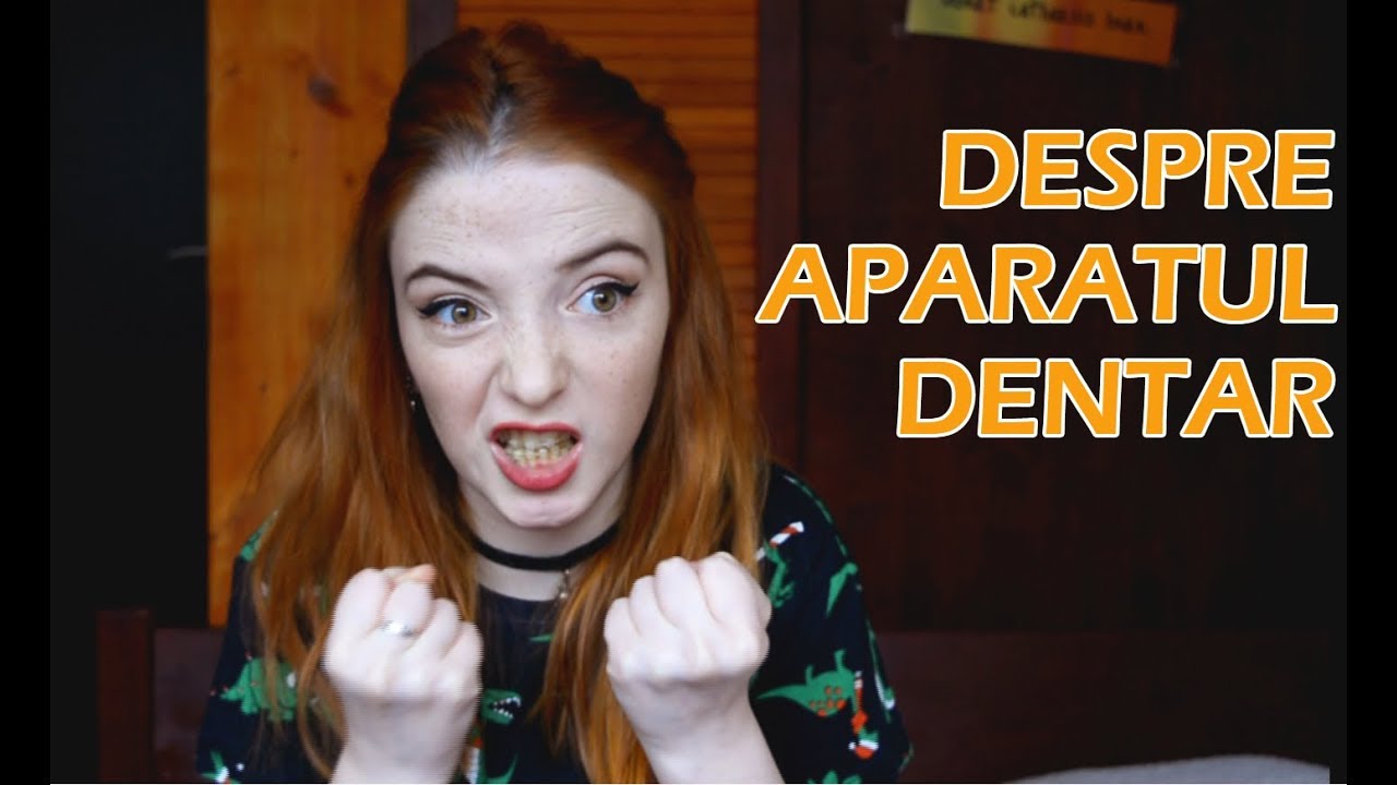 10 lucruri despre aparatul dentar | SCAP DE APARAT!