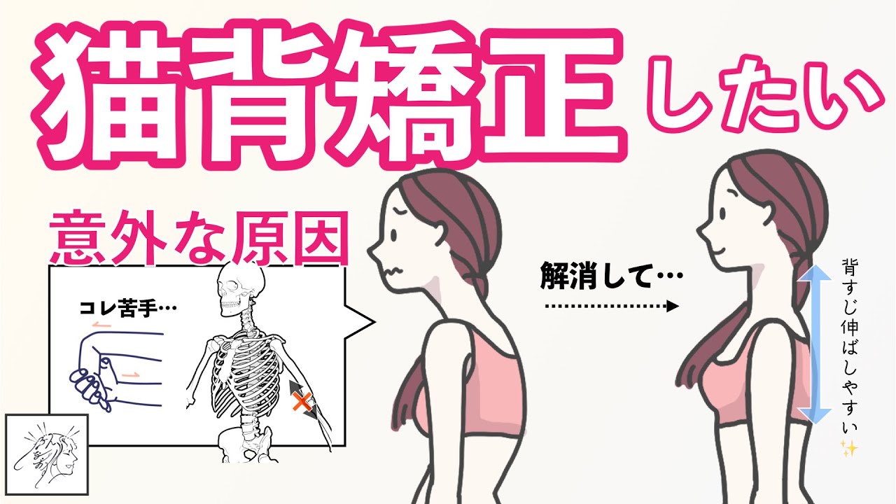 猫背の意外な原因と猫背矯正に使えるストレッチ