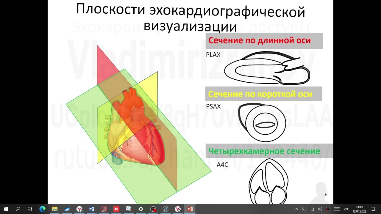 ЭхоКГ  Аккредсценарии 2 и 3  Часть 1  12022 04 12 14 07 36