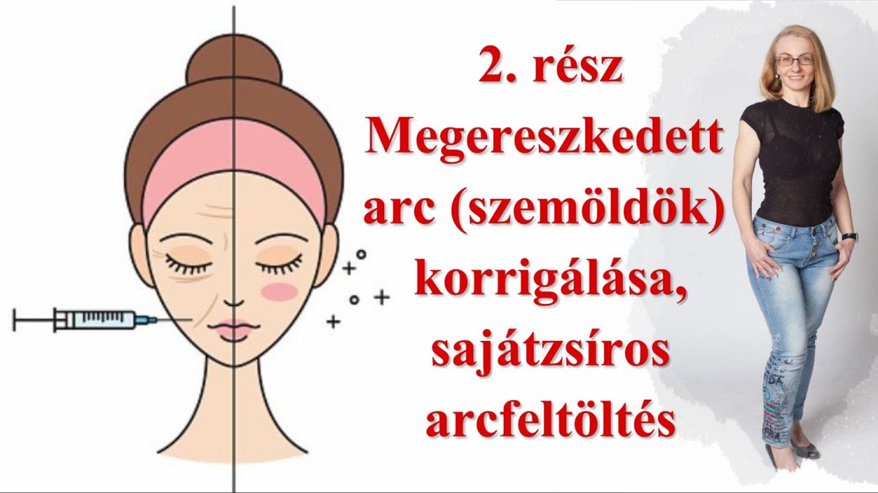 1. rész: Arcfeltöltés saját zsírral - miért jó, hogyan történik?