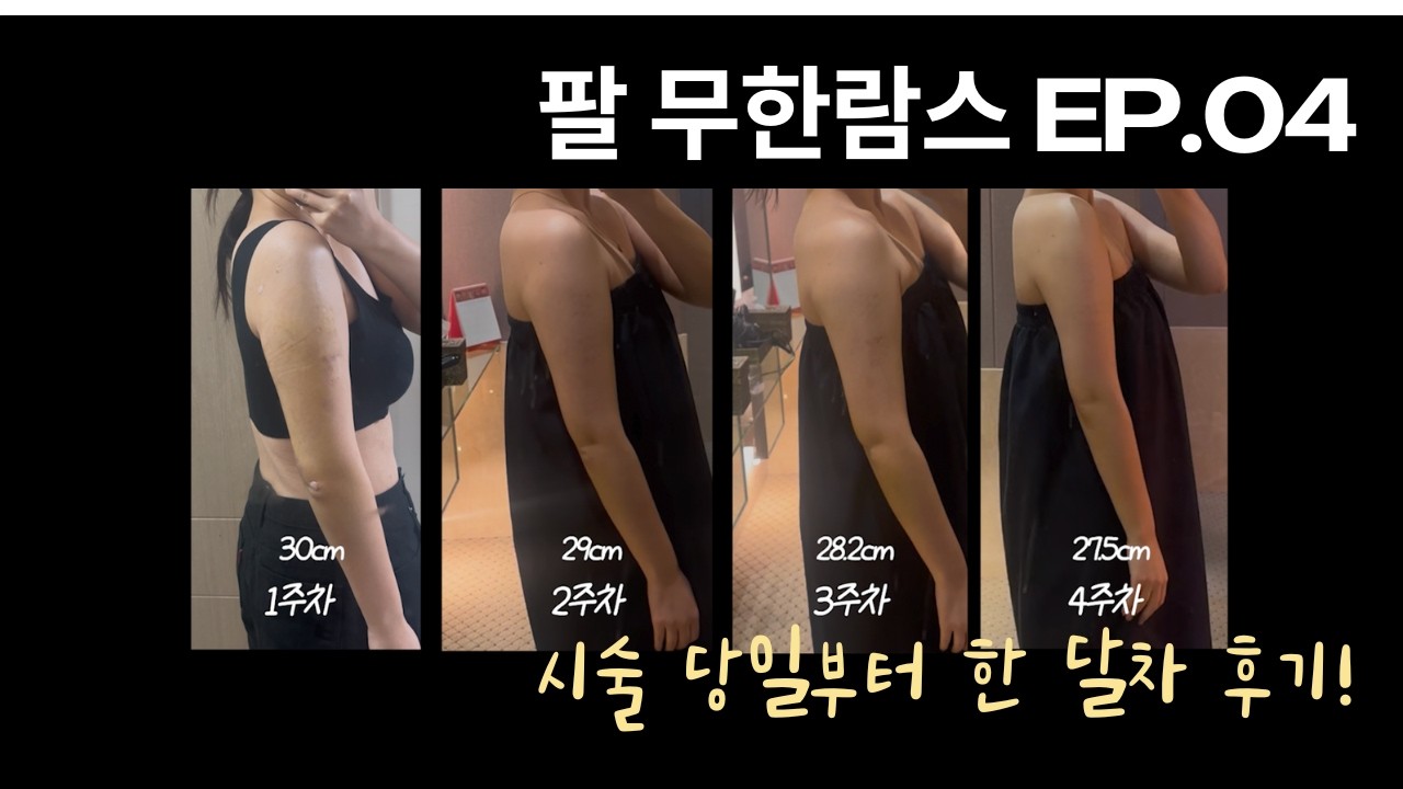 팔, 복부 살빼는주사 무한람스 ep.04ㅣ시술 당일부터 한 달 리얼 후기
