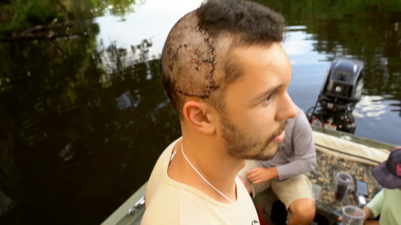 Man Recounts Alligator Attack Where Laundrie Manhunt Ensues