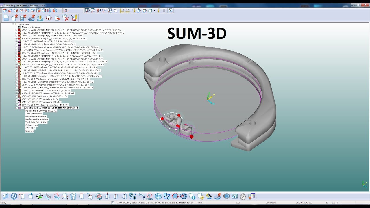 Sum 3D: размещение и просчет стратегии фрезерования/placing crowns and calculating milling strategy