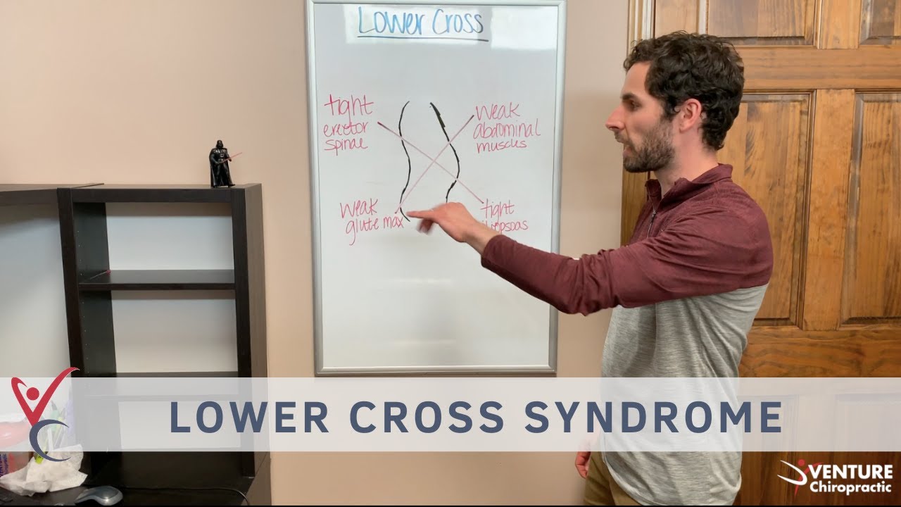 Lower Cross Syndrome