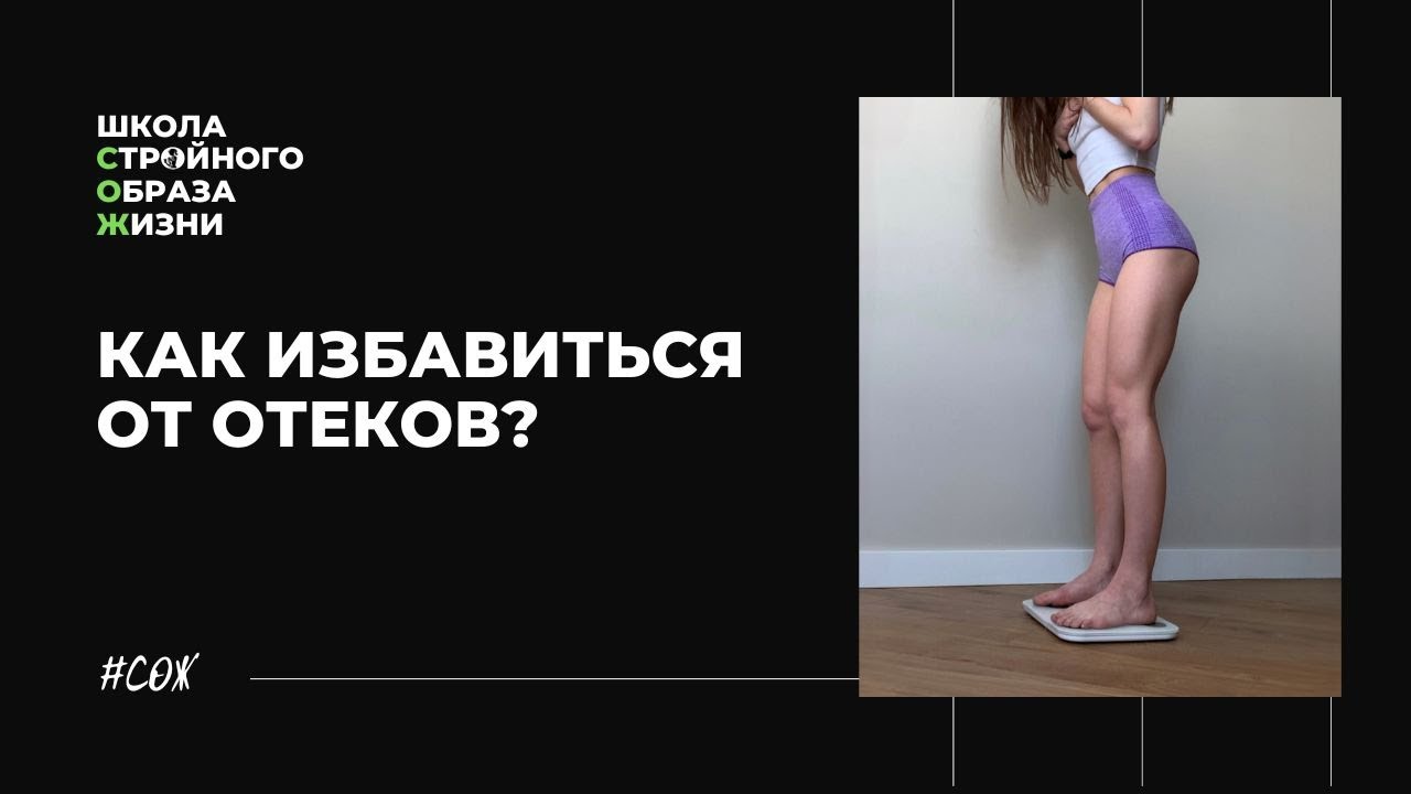 Отеки. Как избавиться?