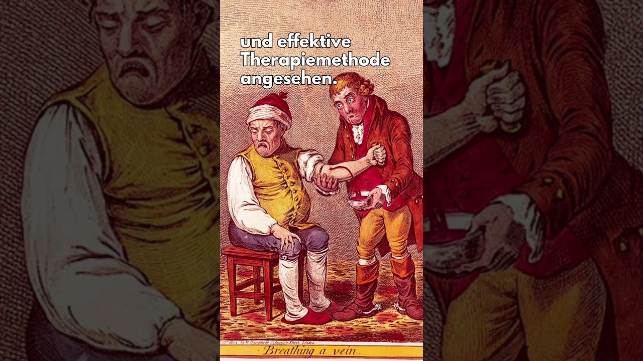 Aderlass als eine h&ouml;chst beliebte & effektive Therapiemethode angesehen. #shorts #anatomy
