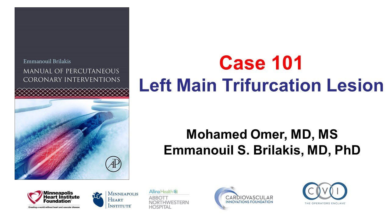 Case 101: PCI Manual - Left main trifurcation