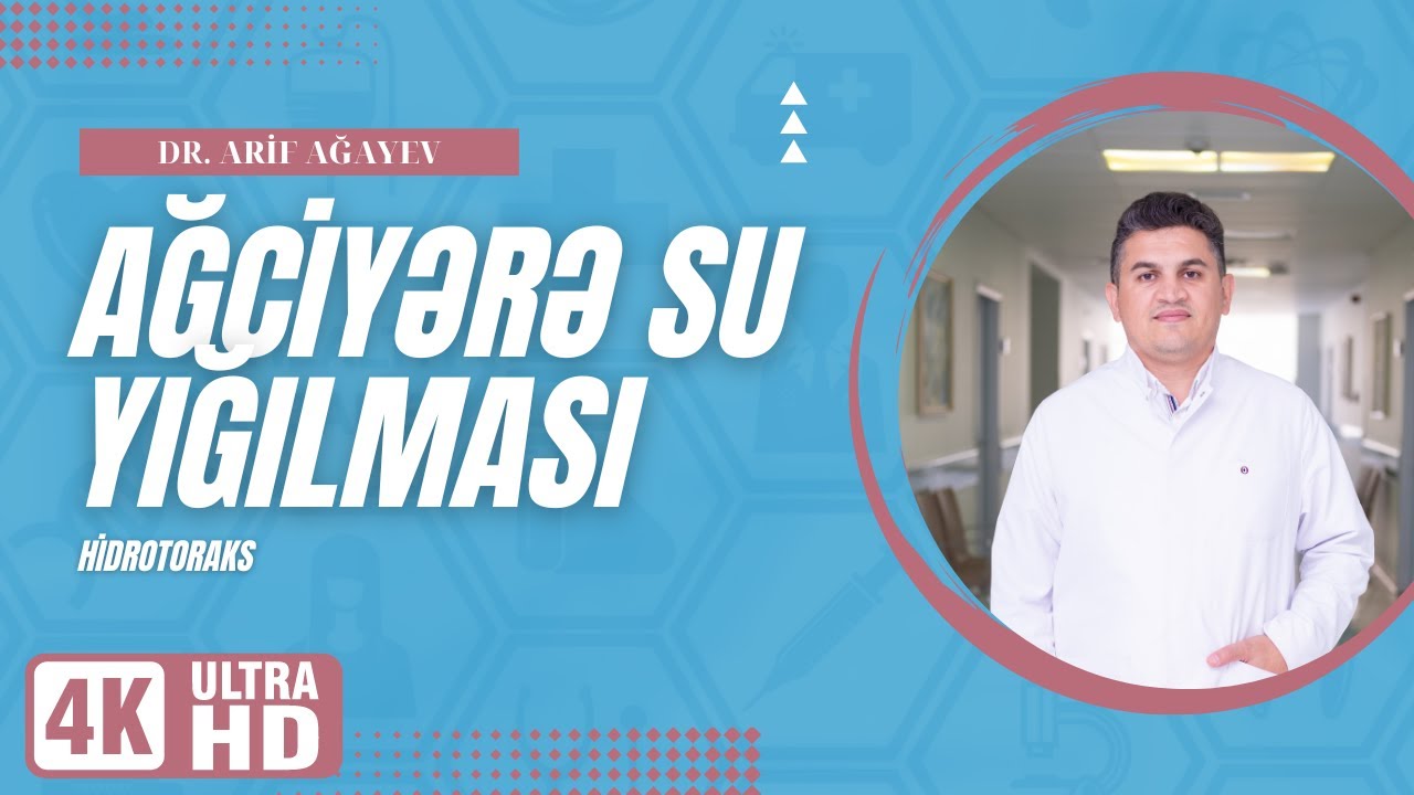 Ağciyərə su yığılması. Hidrotoraks. Maye boşaldılmasına baxmayaraq davamlı yığılarsa ne etməliyik?