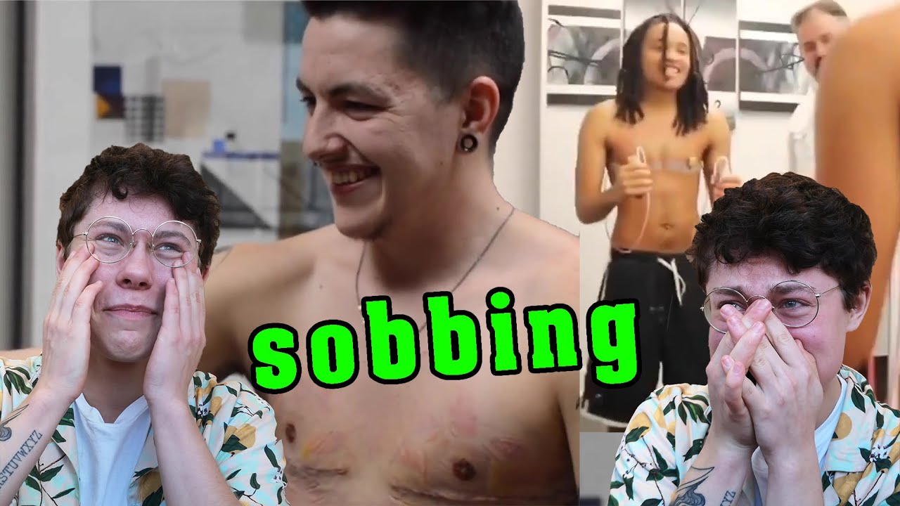 Trans Guy Reacts to FTM Top Surgery Reveals