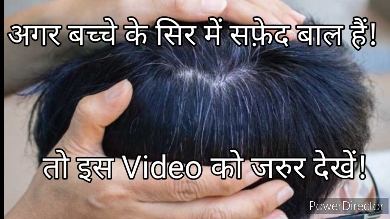 Remedies for the problem of white hair in children