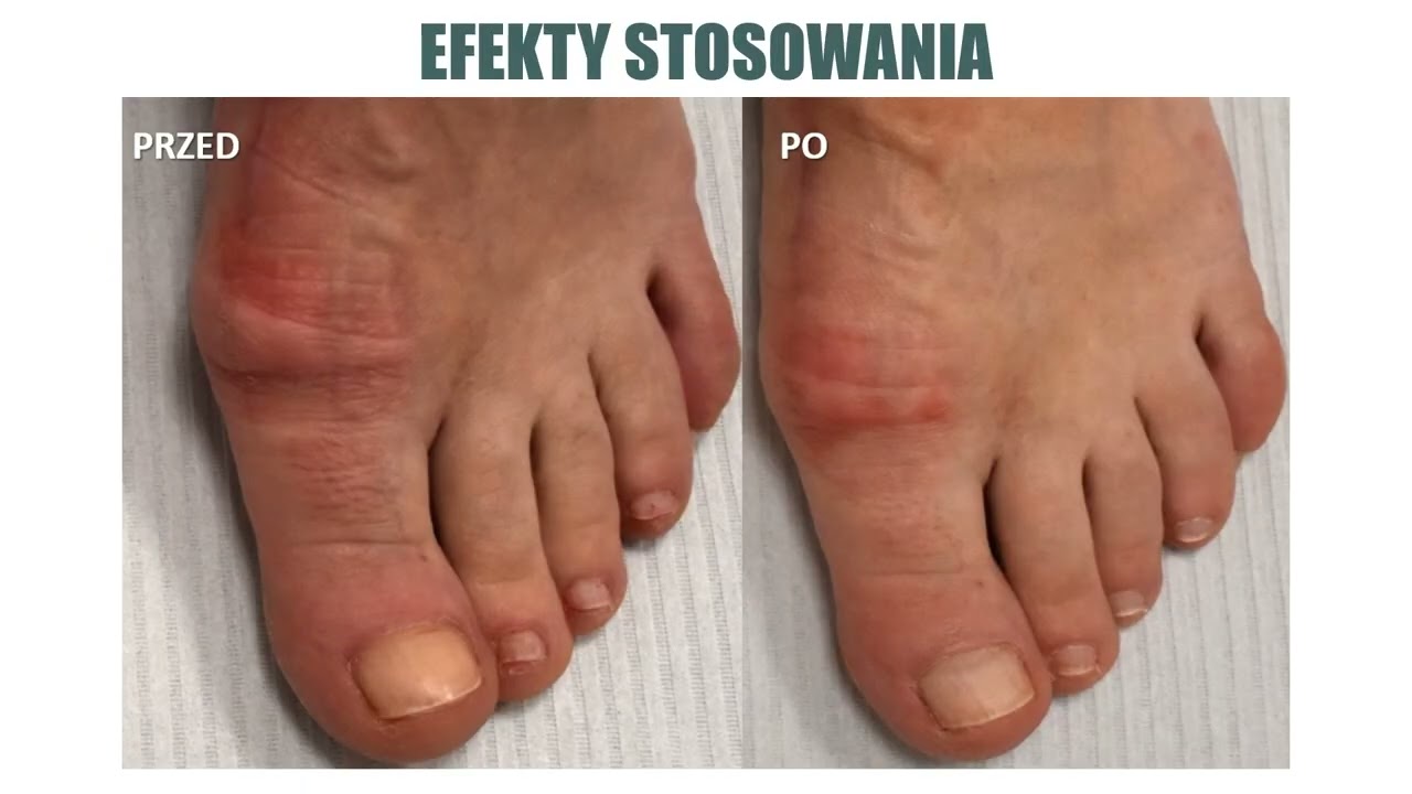 Floslek PODOLOGY Professional preparaty dla podologów #podologia #podolog #floslek #podostore