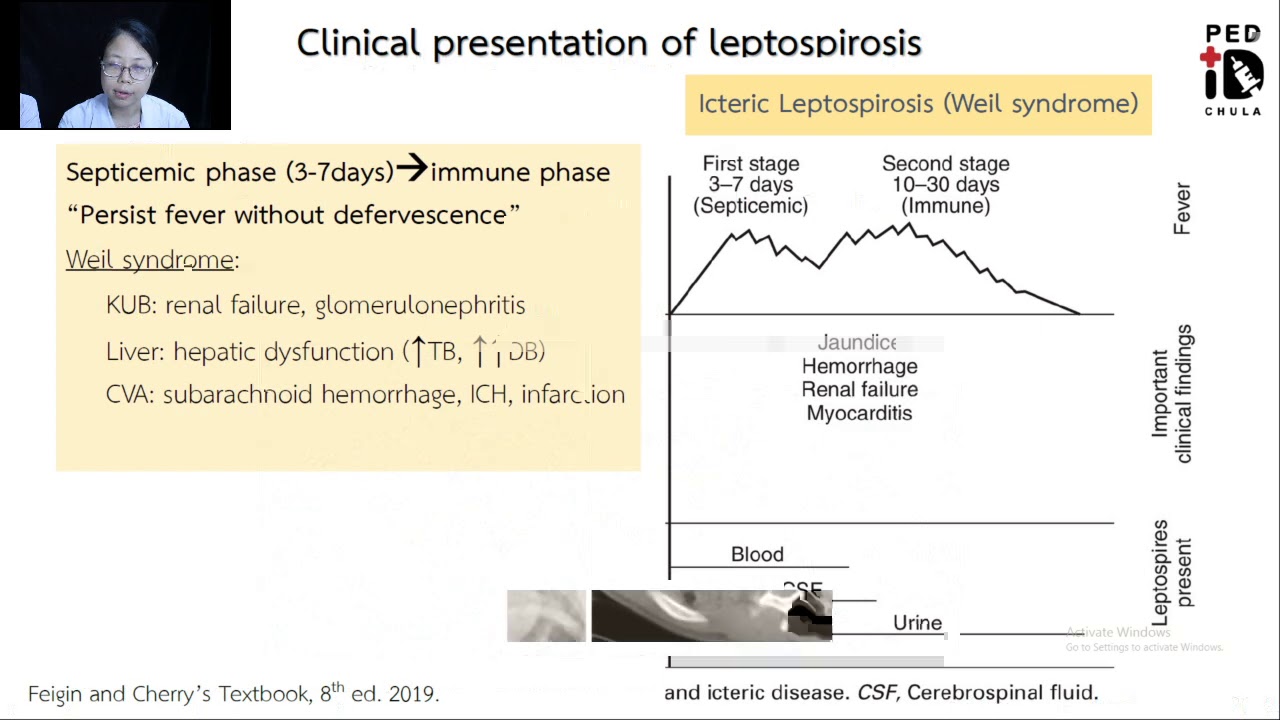 Mini lecture 13 Leptospirosis Clinical presentation & treatment