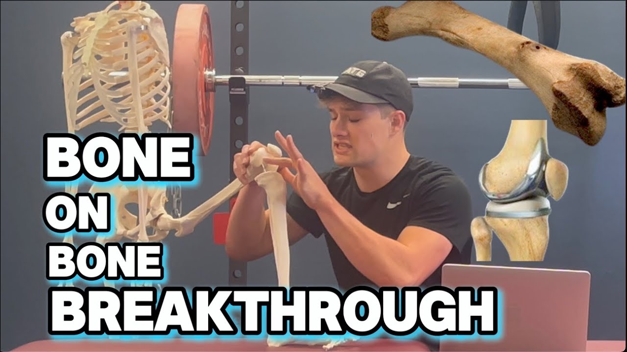 Bone on Bone Breakthrough: No Surgery Solutions For Knee Osteoarthritis