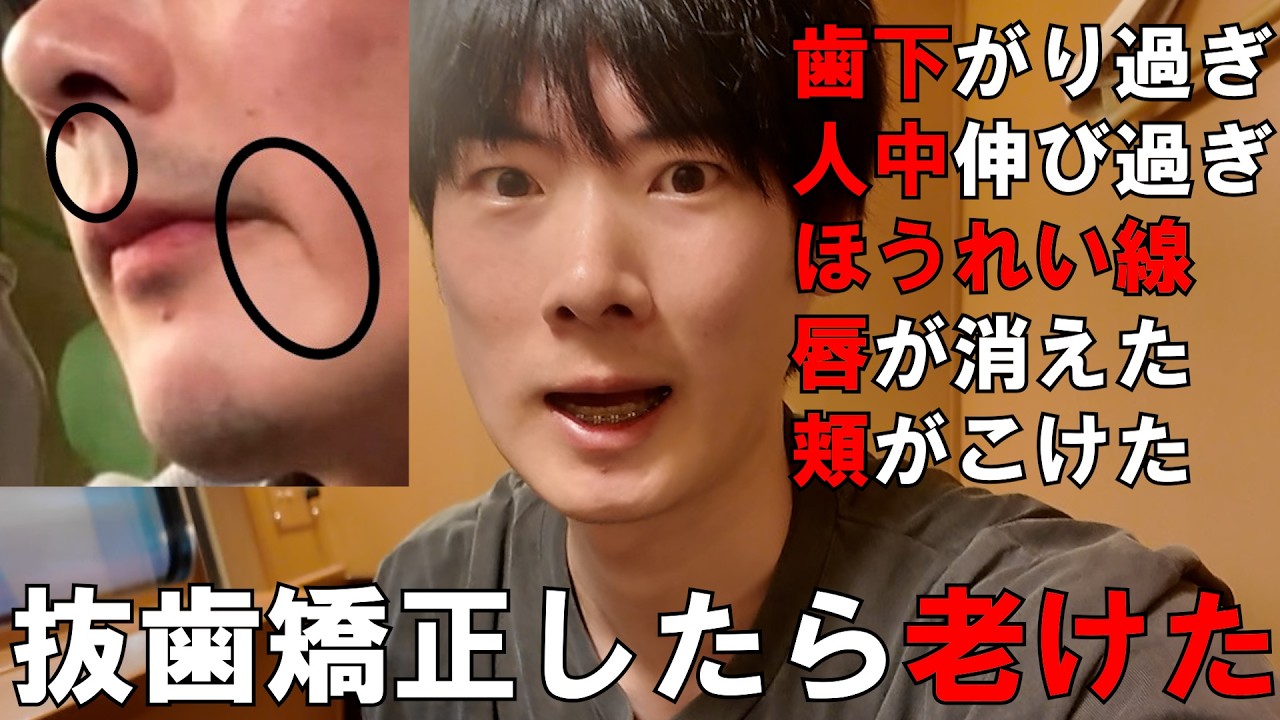 口ゴボが抜歯矯正したら老けた