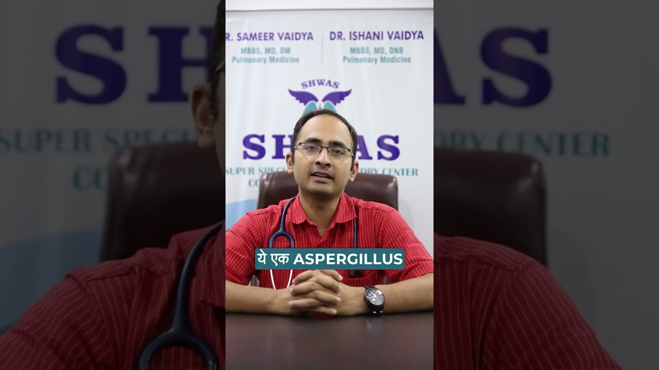 Allergic Bronchopulmonary Aspergillosis (ABPA) - Dr Sameer Vaidhya