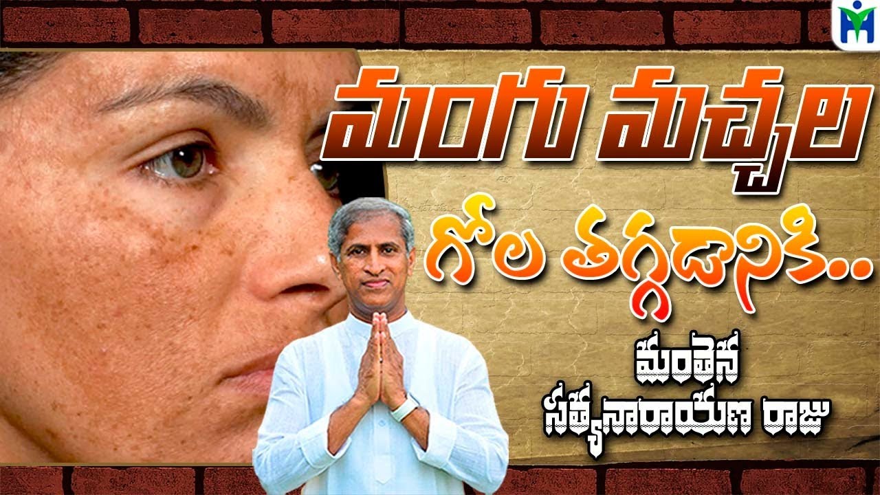 మంగు మచ్చల గోల తగ్గడానికి| Manthena Satyanarayana Raju Videos | Health Mantra |