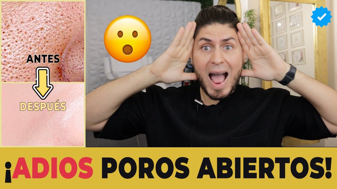 ¿Cómo mejorar los poros abiertos? - TIPS para una piel sana y sin grasa  | DOCTOR LEMUS 🥰