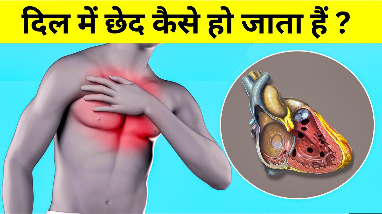 दिल में छेद कैसे हो जाता हैं ? hole in heart