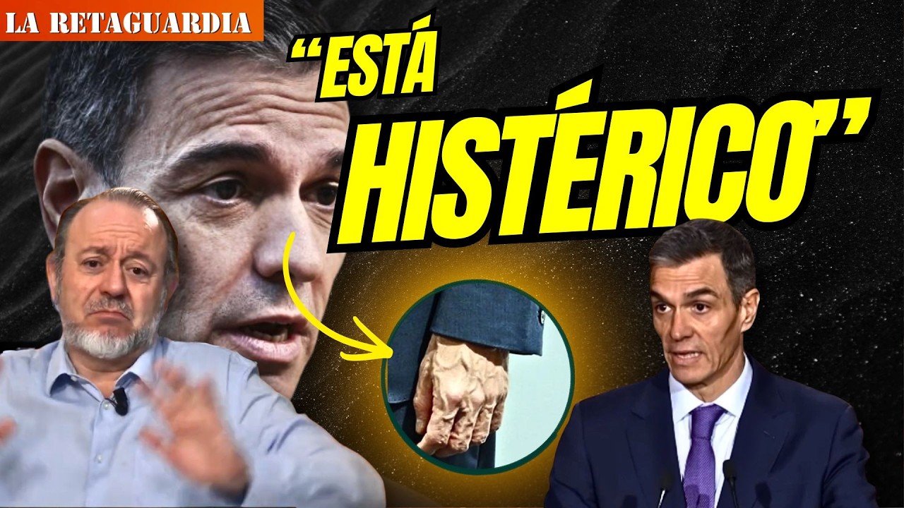 El Pómulo, manos… Eurico resalta un detalle que resalta la enfermedad de Sánchez: 