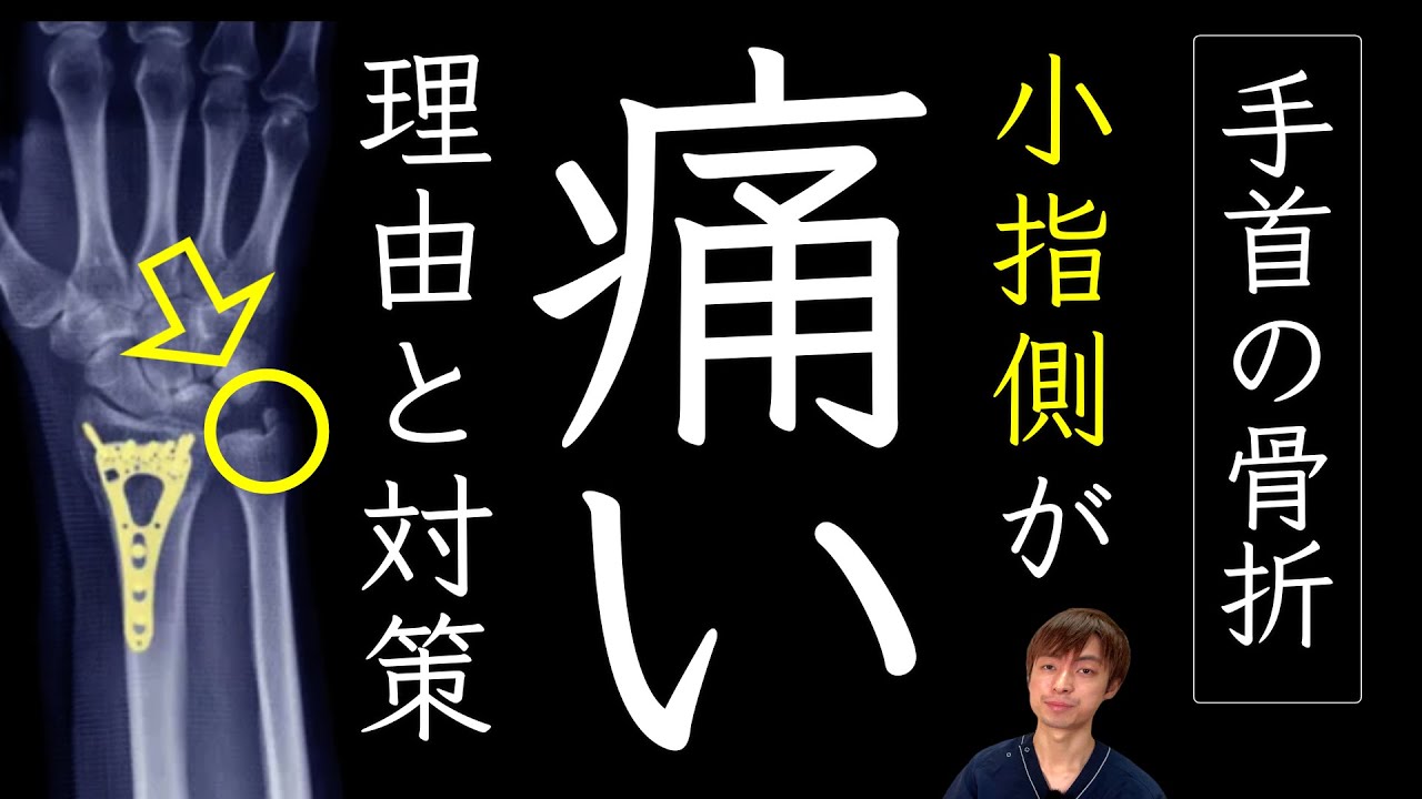橈骨遠位端骨折のあと「小指側の手首が痛い」理由と対処法