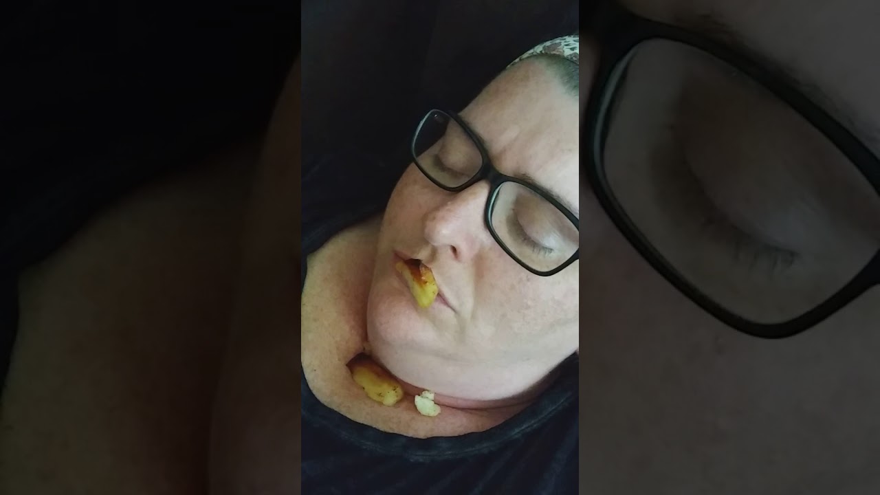 Sleep apnea with fried taters n onions