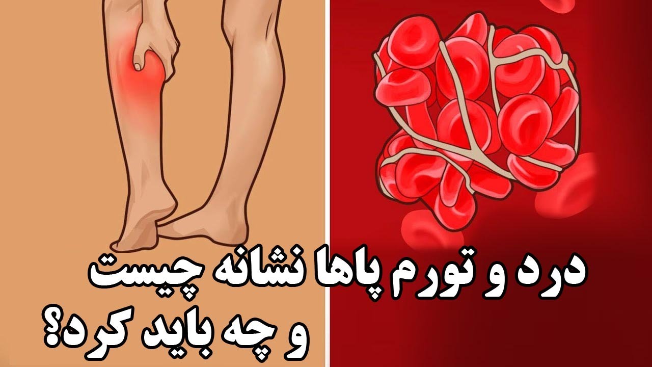 درد و تورم پاها نشانه چیست و چه باید کرد؟