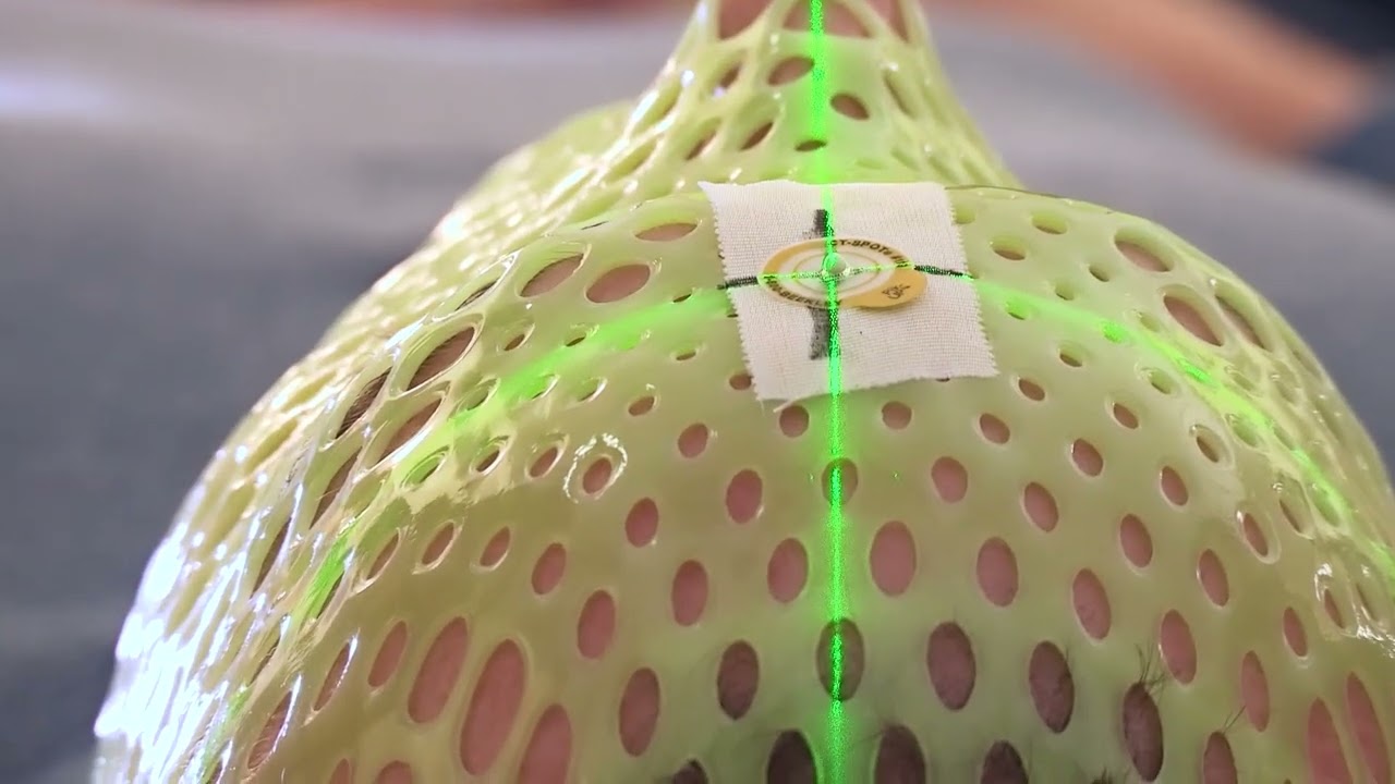 What to expect when having your mask made for proton therapy