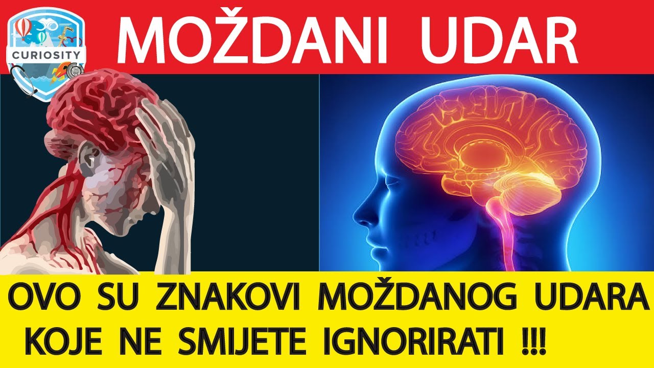 Moždani udar, vrste, uzroci, simptomi, liječenje Dr#120