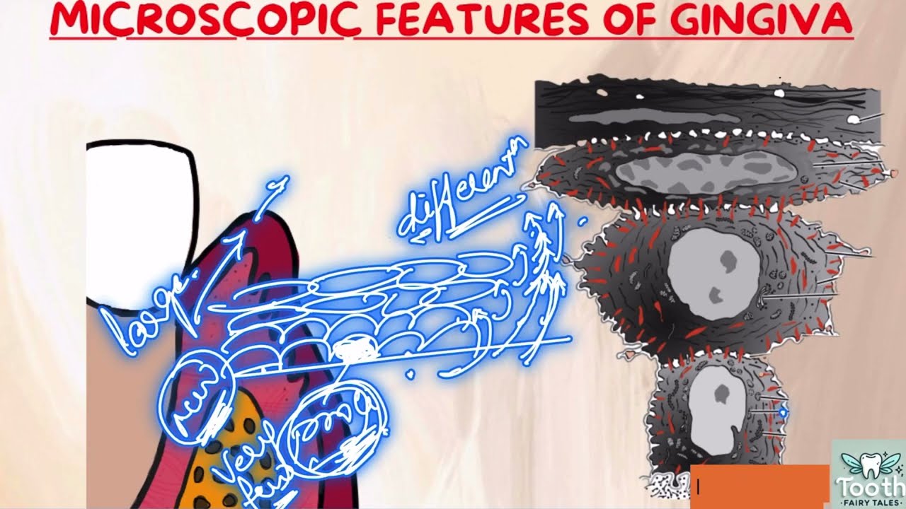 Microscopic features of gingiva I Dental - Keratinization in Gingival epithelium I