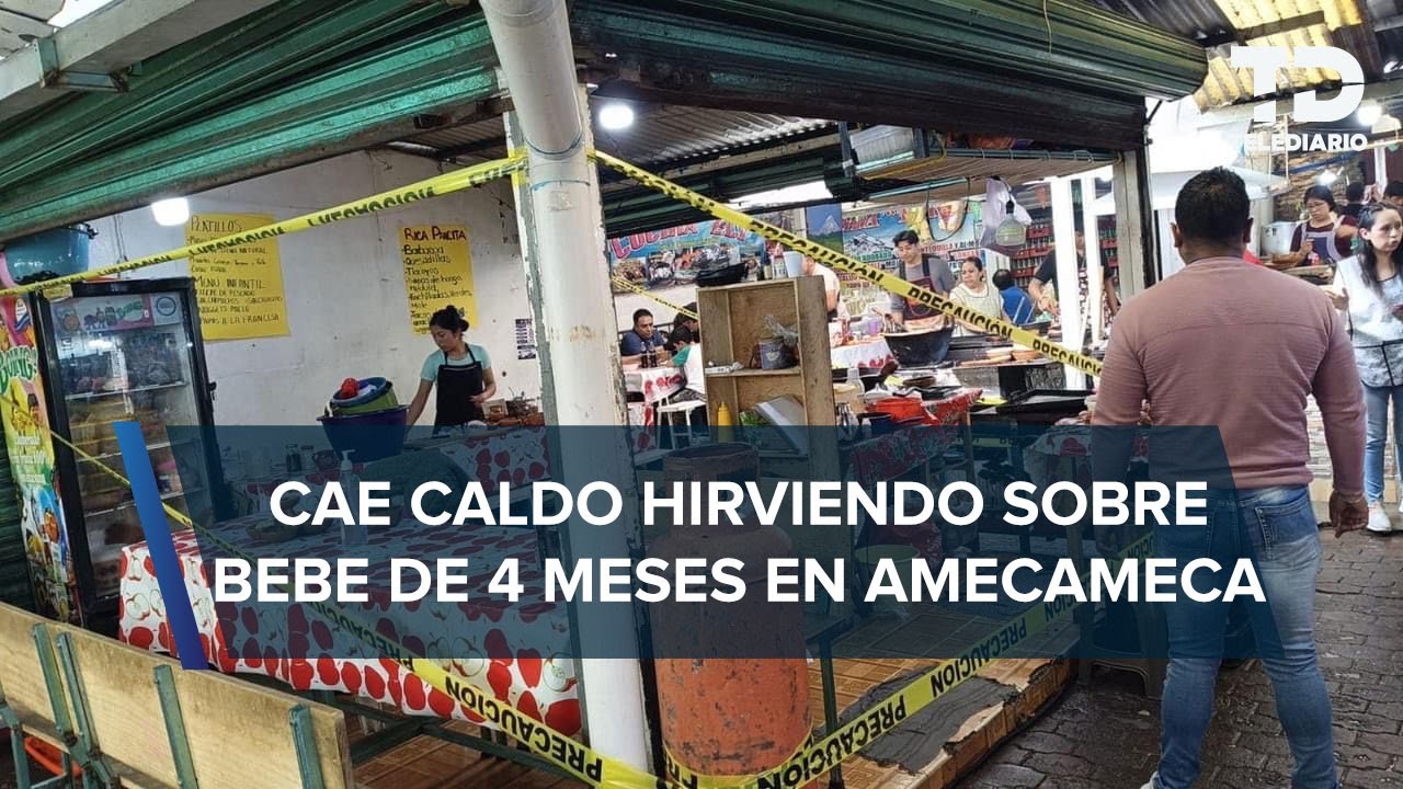 Cazuela hirviendo cae sobre bebé de 4 meses y le deja quemaduras severas en Amecameca