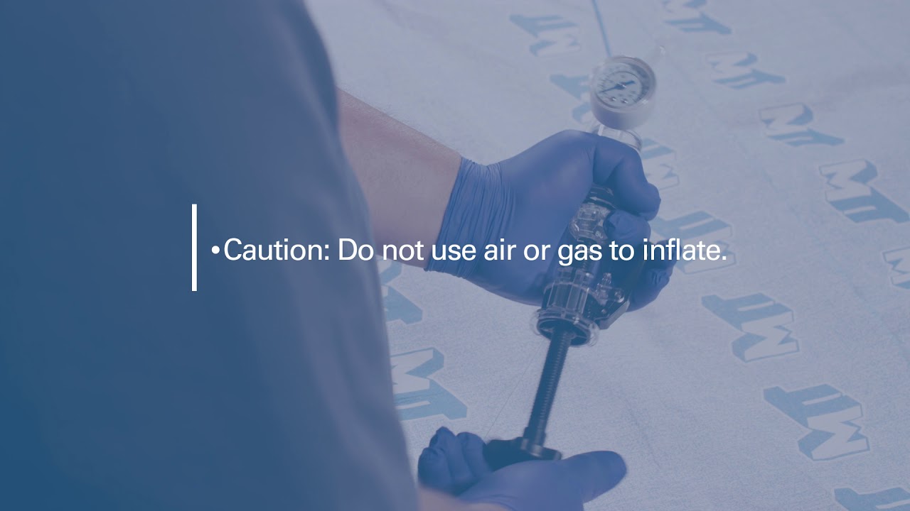 Reliant Multi-Stage Balloon Catheter Tutorial