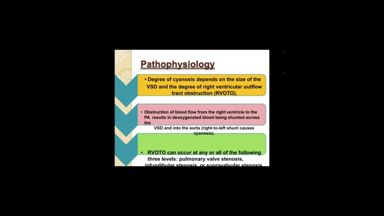 Topic:- Congenital Heart Diseases 