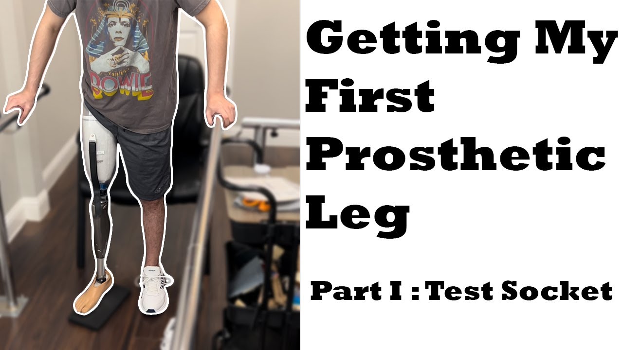 Getting My First Prosthetic Leg | Part 1 : Test Socket