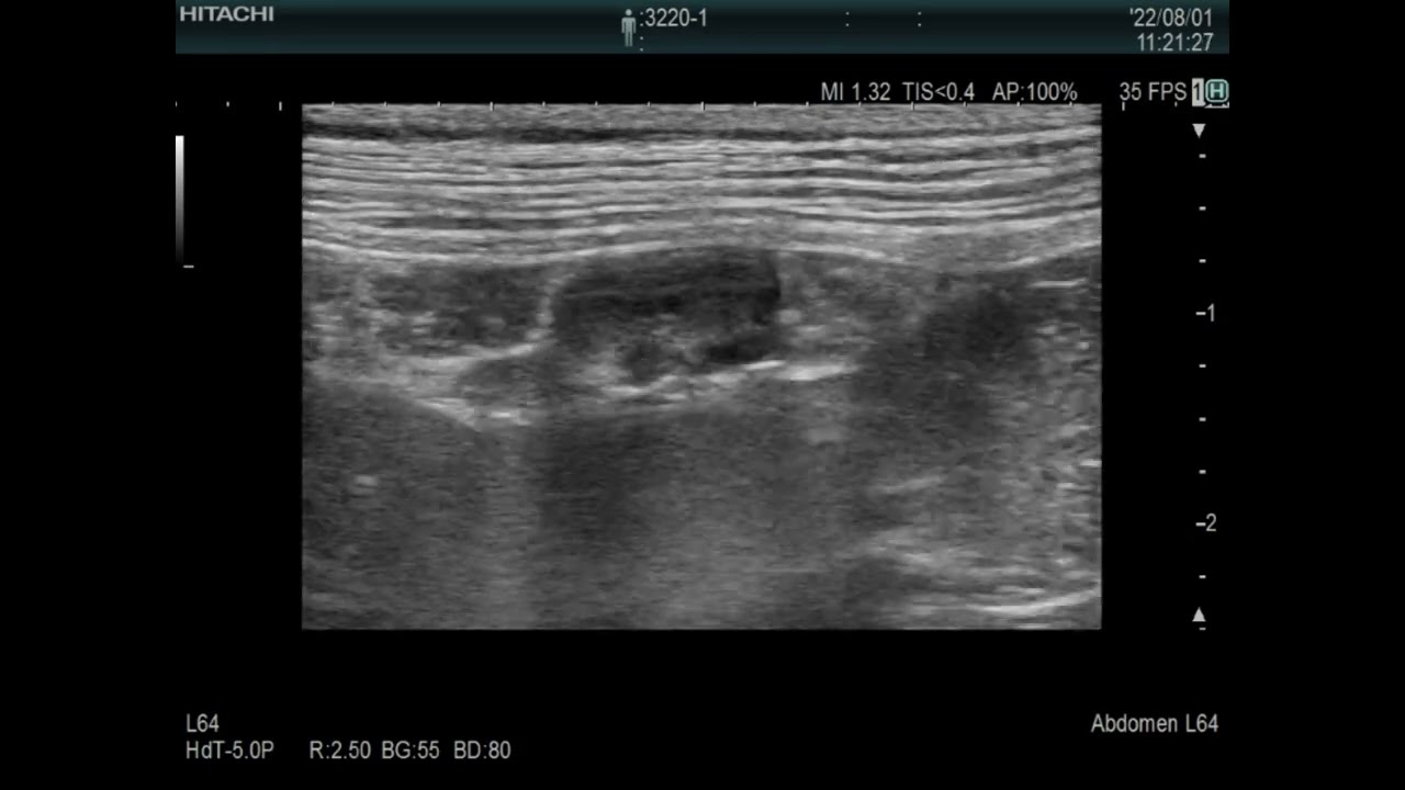 ovary  16 days after heat , Pocket size vs Stationary high-end system、eho images、dog（8kg)　犬の卵巣