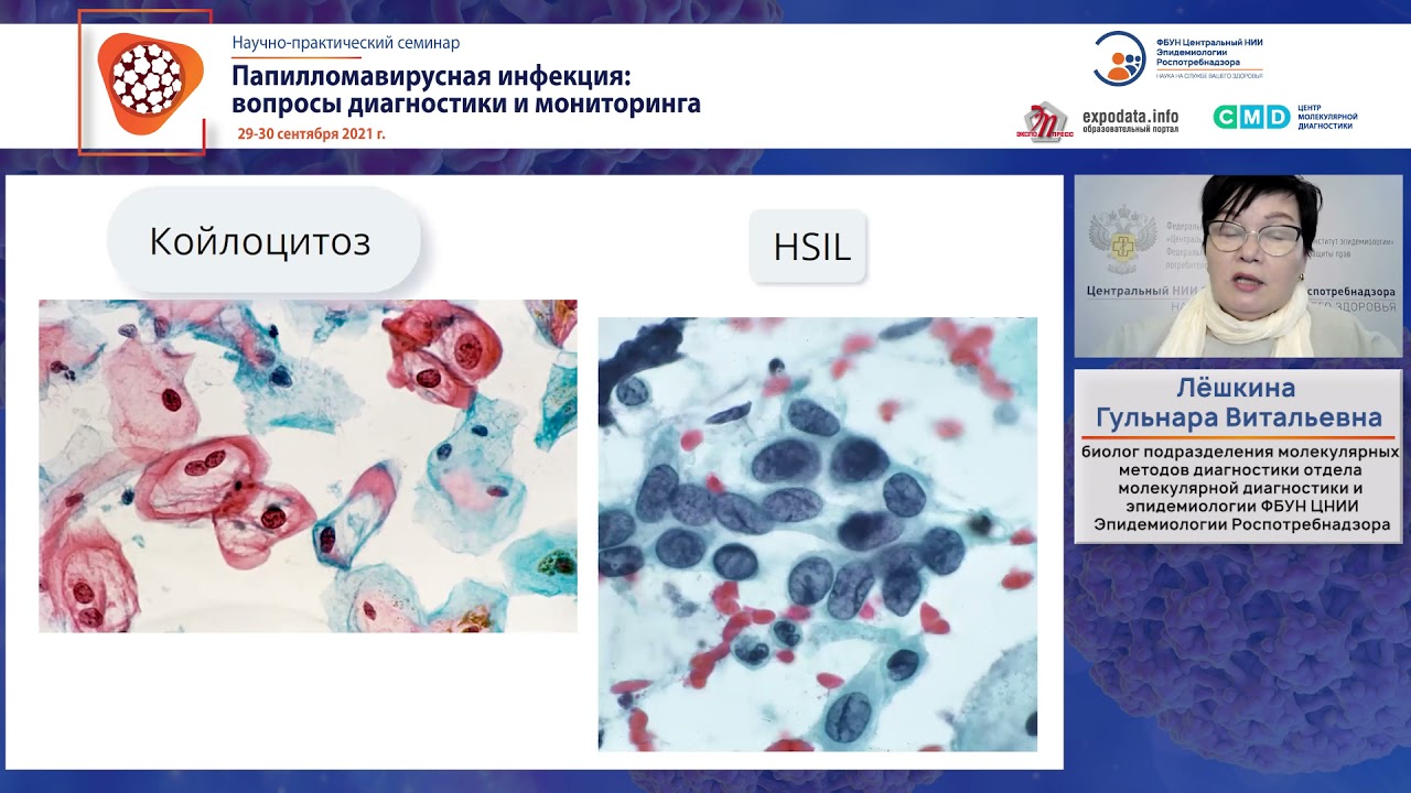 Роль цитологических и иммуноцитохимических исследований в диагностике онкопатологии шейки матки