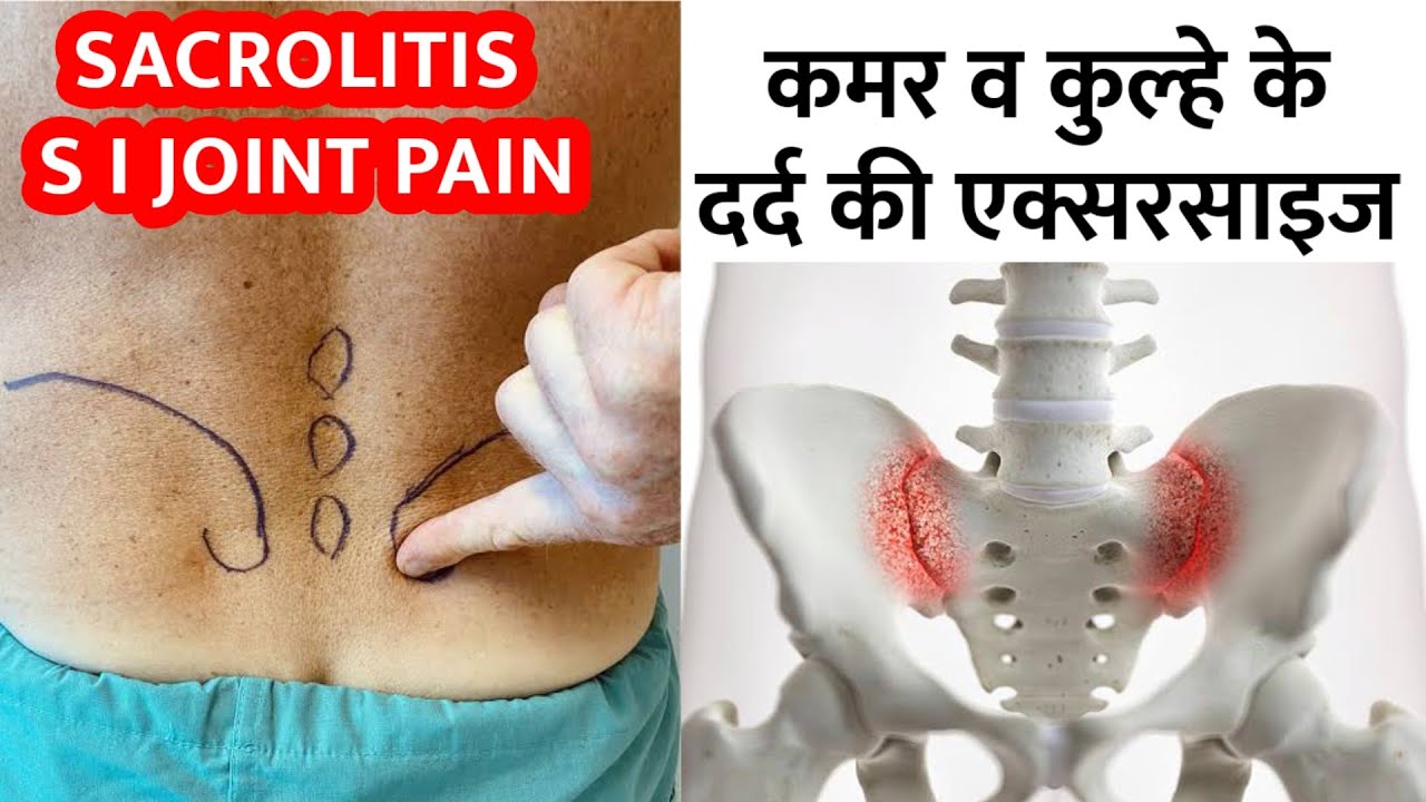 Sacroiliac Joint Pain Exercises | कमर व कूल्हे के दर्द का इलाज | Sacroiliitis treatment in hindi
